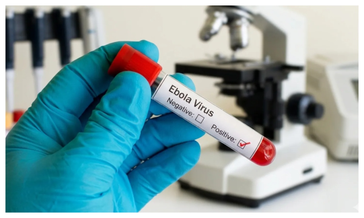 Ebola Symptoms Resemble Malaria, Warns Health Expert