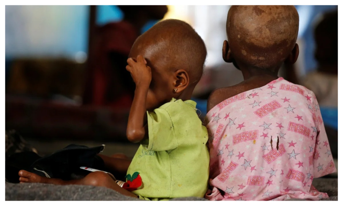 MSF Malnutrition Report: Over 440,000 Nigerian Children Treated in 2025